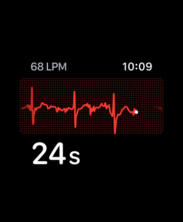 App ECG, latidos por minuto en la esquina superior derecha, línea de ritmo cardiaco, temporizador